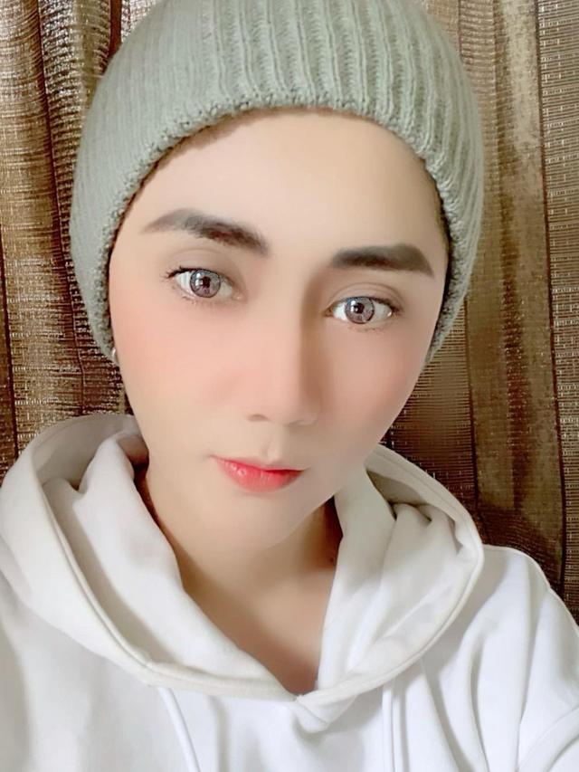 Aida Saskia Jalani Kemoterapi