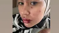 Unggahan Kartika Putri. (Foto: Dok. Instagram @kartikaputriworld)
