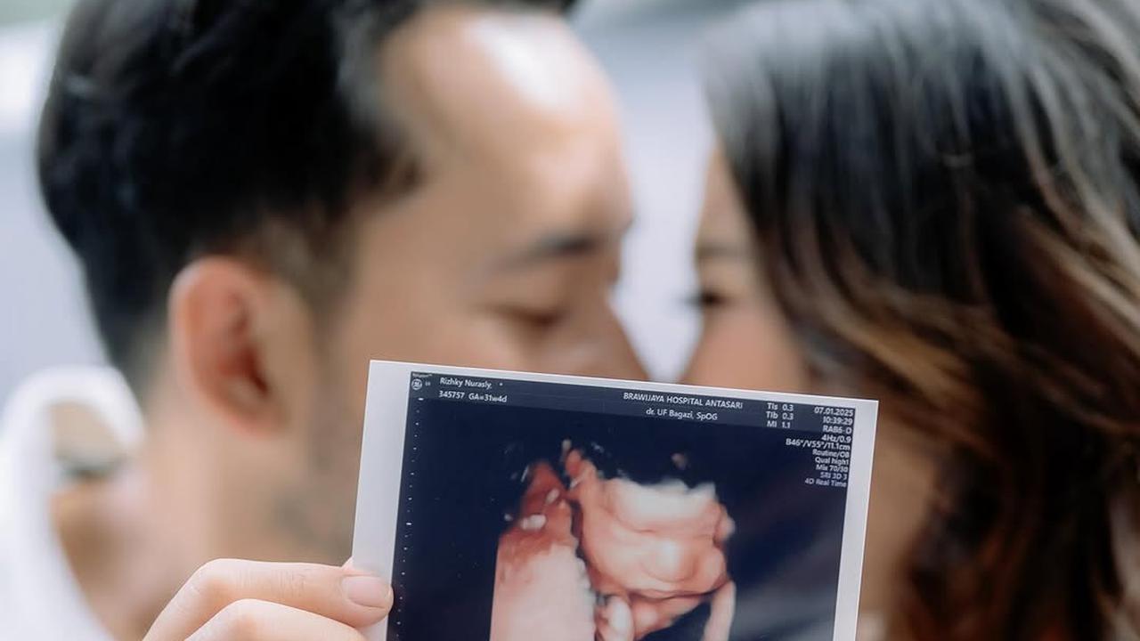Pamer Foto USG, Ini Potret Kiky Saputri dan Muhammad khairi Jalani Maternity Shoot