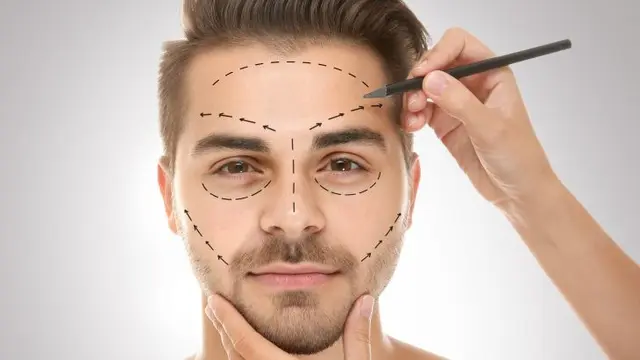 Ilustrasi Operasi Plastik