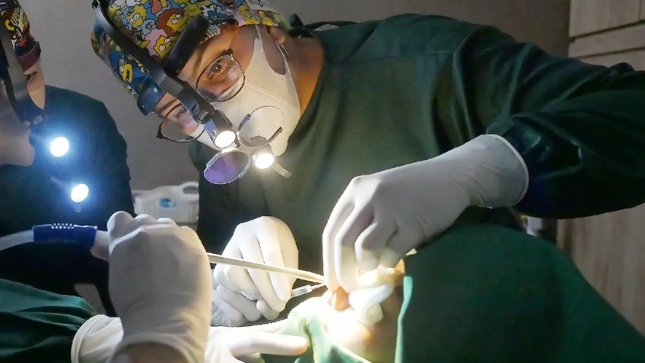 Rhinoplasty