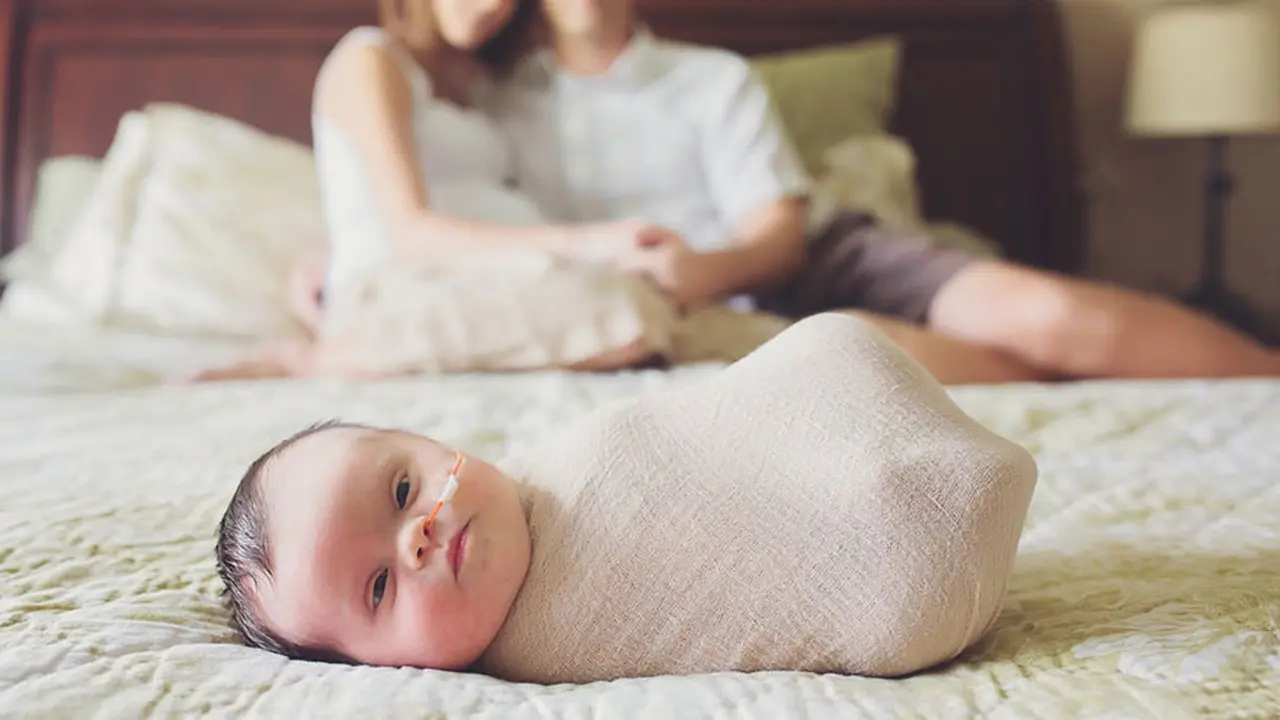 Terkena Tumor Otak, Dokter Bilang Bayi Ini Tak Bisa Bertahan Lama