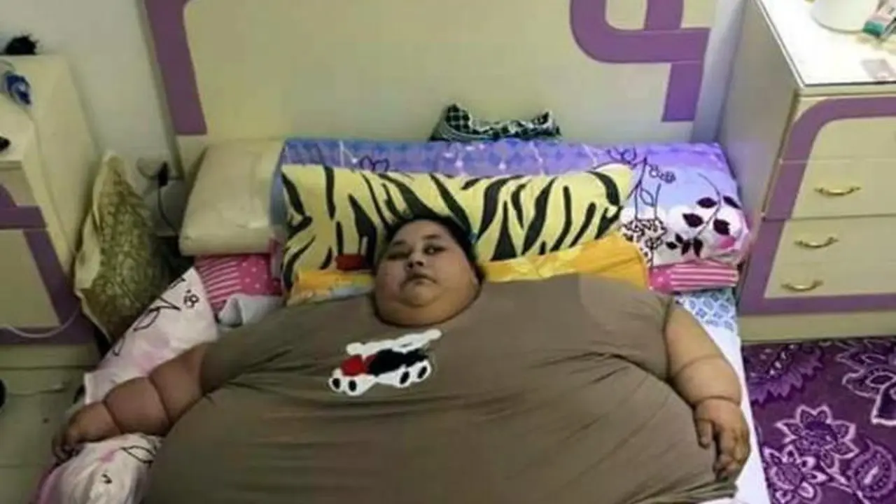 Perempuan Tergemuk Sedunia, Berat Badan Eman 500 Kg
