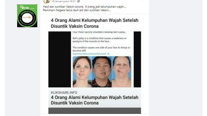 Cek Fakta Liputan6.com mendapati klaim foto orang mengalami kelumpuhan wajah setelah divaksin corona