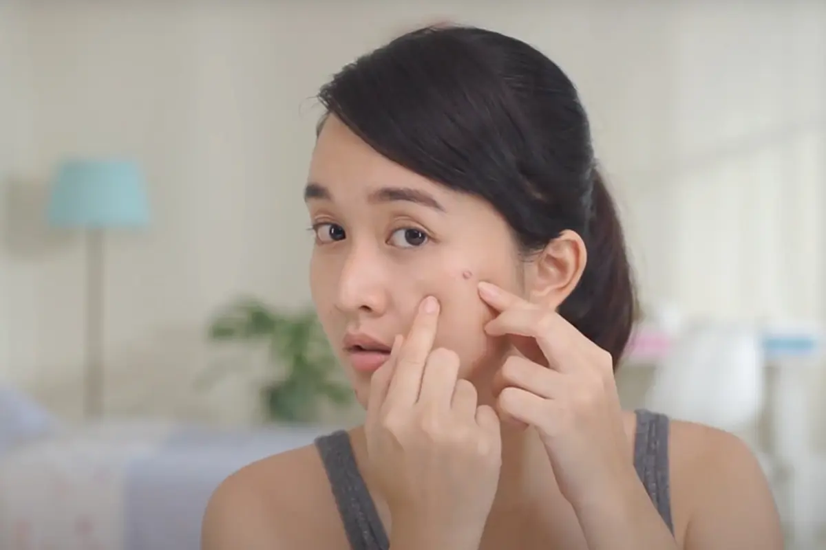 3 Langkah Cepat Usir Jerawat dan Minyak Berlebih di Wajah dengan Mudah, Penasaran?