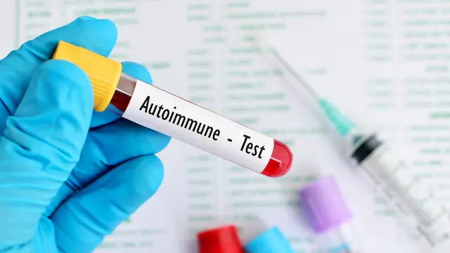 Penyakit Autoimun, Bisakah Disembuhkan? (Jarun Ontakrai/Shutterstock)