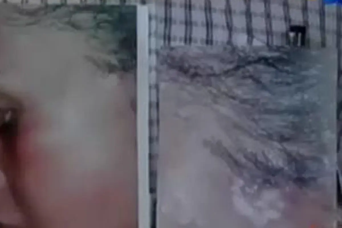 VIDEO: Dugaan Malapraktik, Pipi Wanita Ini Terus Keluar Cairan