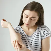 Mengapa Anak Bisa Terkena Panu? Ini Cara Mengobatinya dengan Tepat