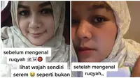 Perubahan Wajah Wanita Ini Pakai Ayat Ruqyah. (Sumber: TikTok/ @yennarachman)