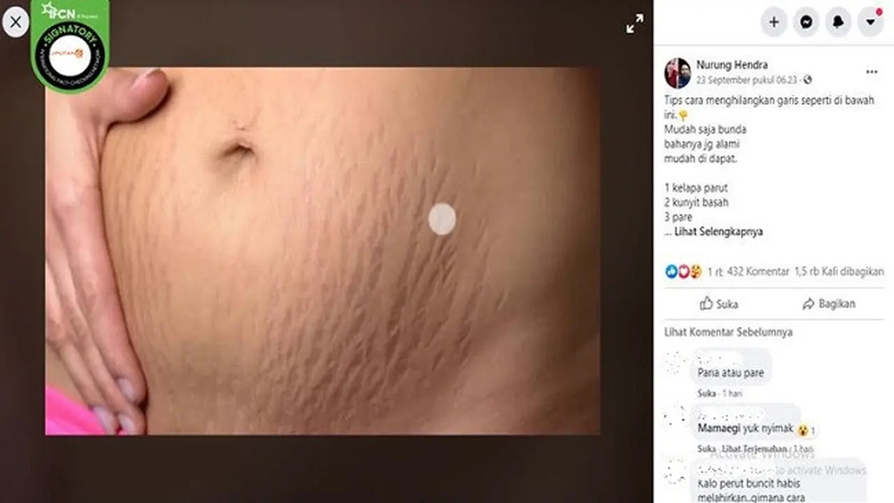 Gambar Tangkapan Layar Foto Stretch Mark (sumber: Facebook)