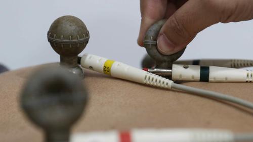 Pemeriksaan EKG adalah metode diagnostik non-invasif yang digunakan untuk merekam aktivitas listrik jantung. (Foto:  Herman Zakharia/Liputan6.com)