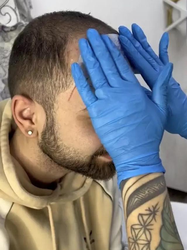 Mentato Kepala Botak