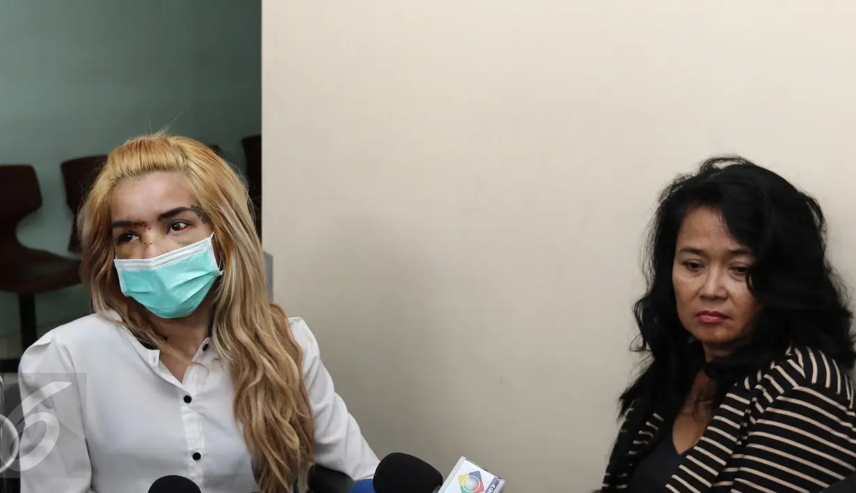Aktris peran Sheila Marcia ditemani sang ibu menjawab pertanyaan awak media di Rumah Sakit Medistra, Jakarta, Selasa (9/5). Sheila yang beberapa hari terakhir mendapat perawatan akibat kecelakaan mobil sudah diizinkan pulang (Liputan6.com/Herman Zakharia)