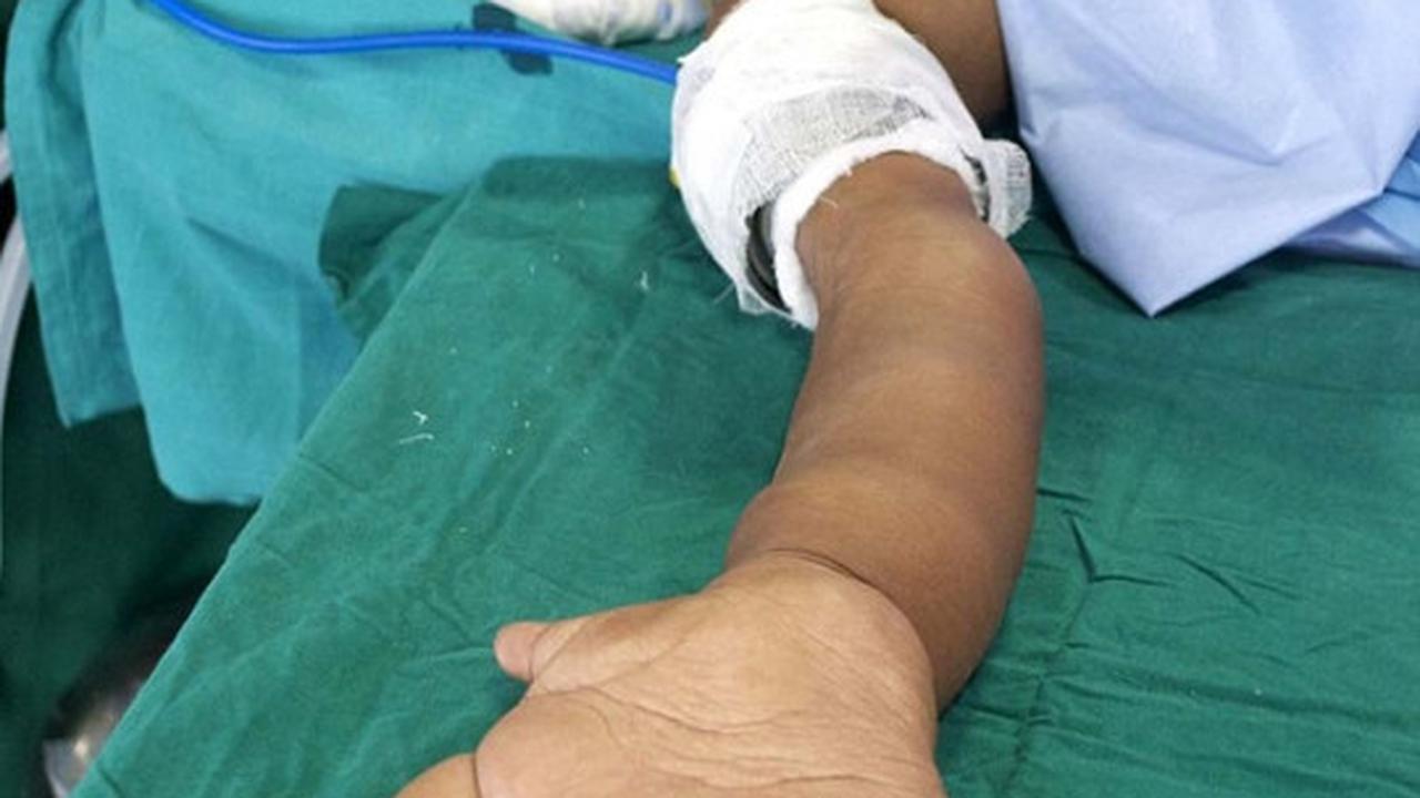Bocah ini miliki tangan terbesar di dunia