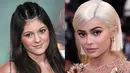 Agar dirinya lebih percaya diri, Kylie Jenner mengaku dirinya melakukan lip injection. (Rex/Shutterstock/HollywoodLife)