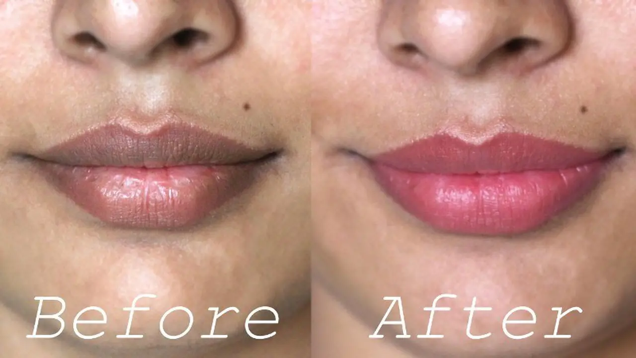 6 Tips Hilangkan Bibir Menghitam dengan Bahan Alami