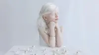 Di tangan seorang fotografer, orang-orang yang albino terlihat indah dan cantik. (Foto: Instagram/@yuliataitsphoto)