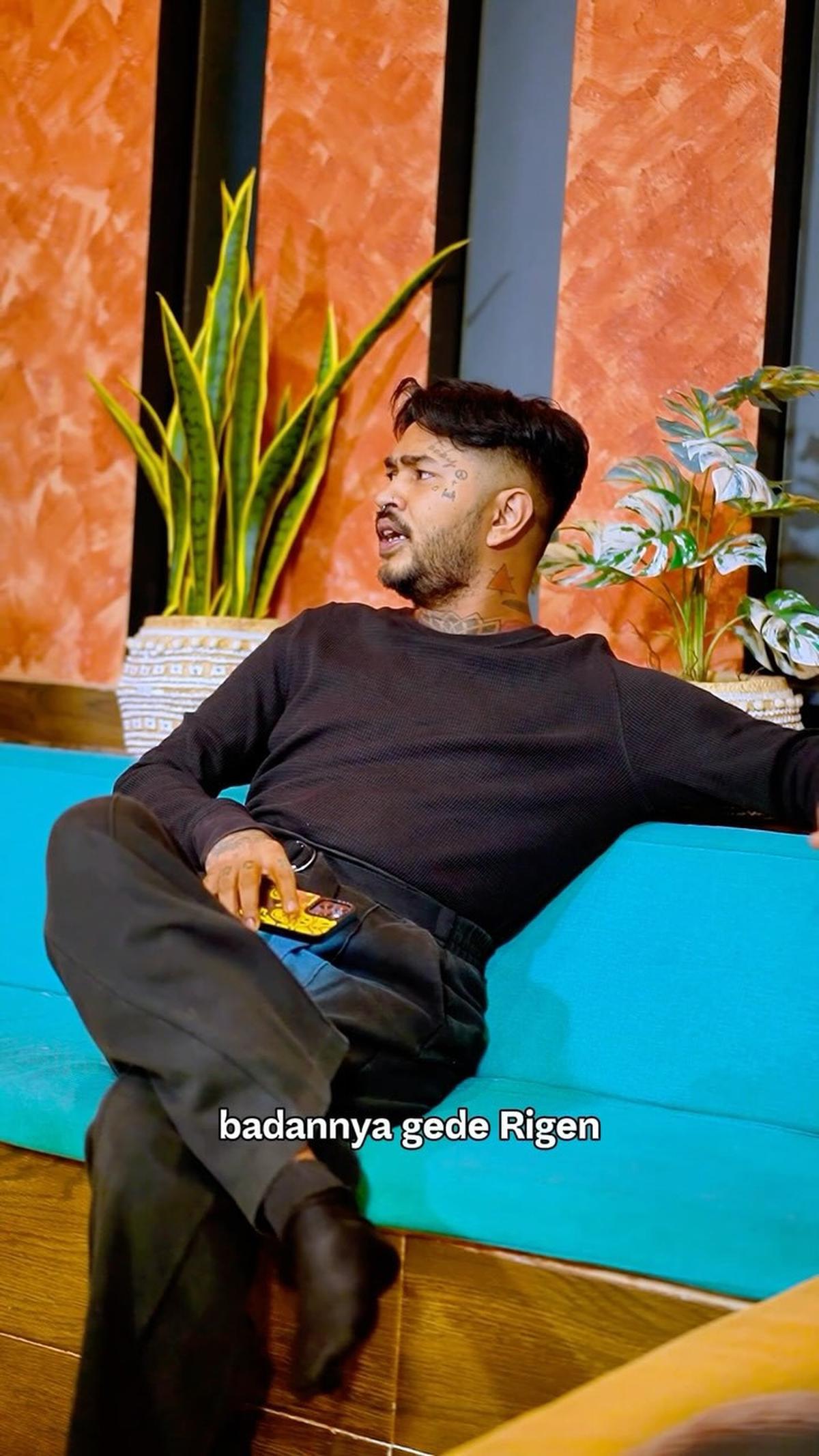 Onadio Leonardo Alami Insiden saat Manggung hingga Kakinya Diperban