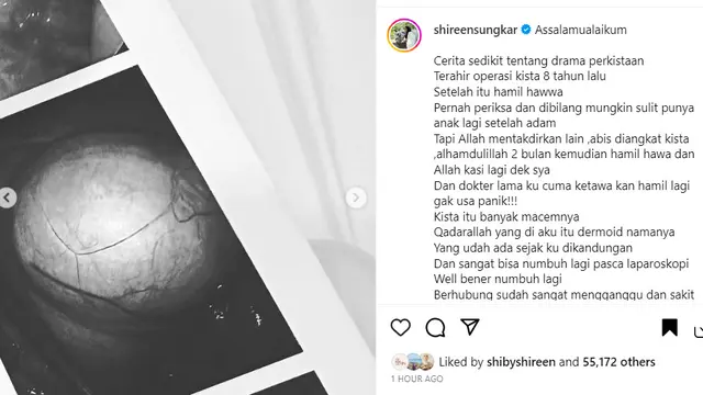 Shireen Sungkar