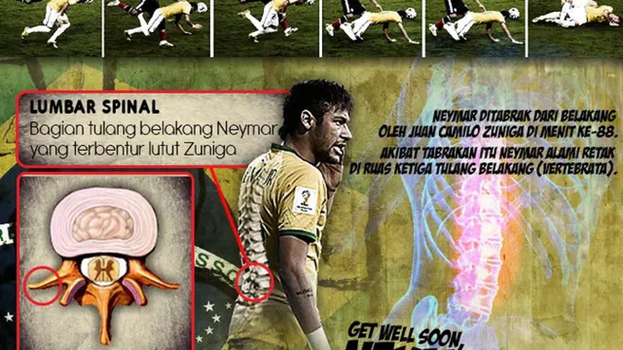 Infografis Cedera Tulang Belakang Neymar (Liputan6.com/Yoshiro)