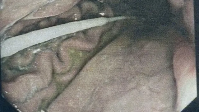 Tes Swab Covid-19