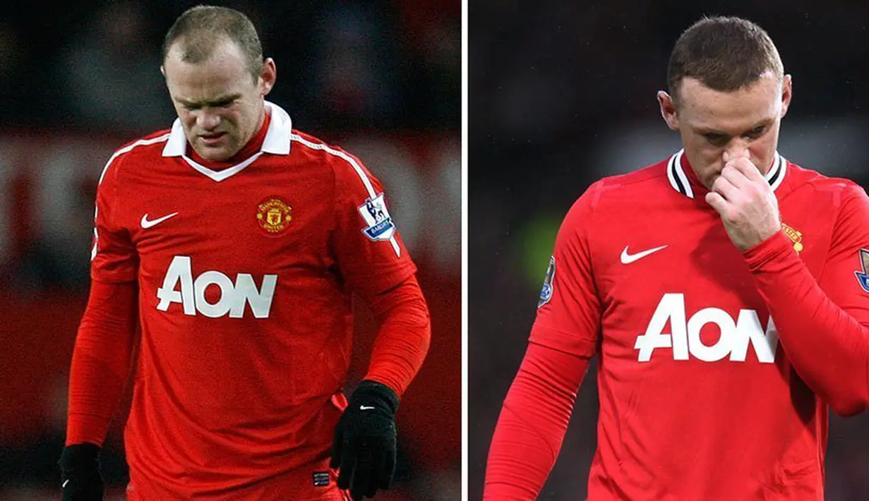 Striker Manchester United, Wayne Rooney, melakukan transplantasi rambut pada tahun 2011. (www.squawka.com)