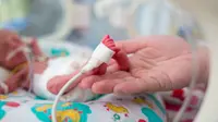 Bayi Prematur Berisiko Disabilitas, Butuh Intervensi Medis yang Tepat Waktu