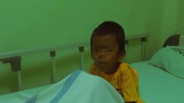 Gizi Buruk Hantui Penyandang Disabilitas di Kecamatan Termiskin di Musi Banyuasin