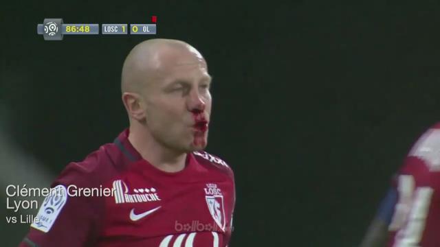 Brutal, Sikut Lawan Hingga Berdarah Grenier di Ganjar Kartu Merah