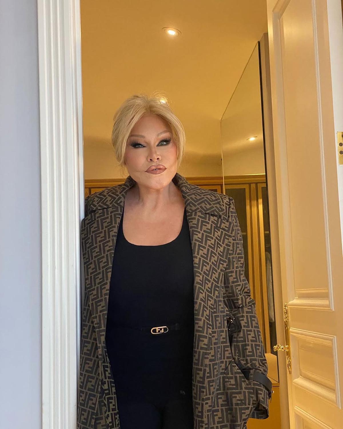 Jocelyn Wildenstein, Perempuan Berjuluk Catwoman Meninggal Dunia