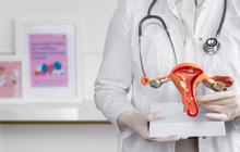 4 Makanan Ini Bisa Memperparah Endometriosis — Nomor 2 Sering Dikira Sehat!