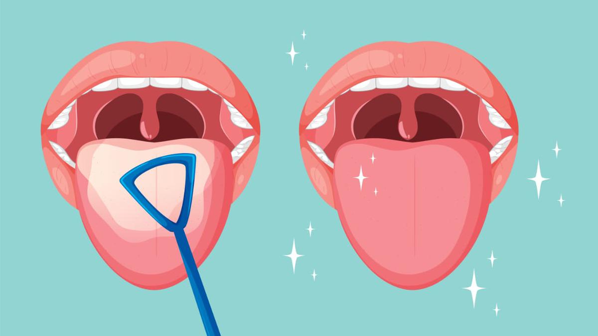 Tak Banyak Disadari, Ini 5 Manfaat Membersihkan Lidah bagi Kesehatan