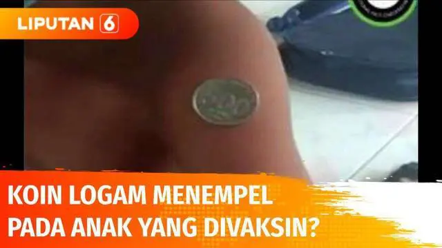 Beredar informasi uang koin logam bisa menempel pada lengan anak setelah divaksin. Fakta atau hoaks?