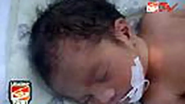 Bayi yang Dibuang di Pot Bunga Membaik