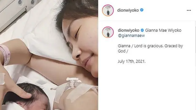 Istri Dion Wiyoko Lahirkan Anak Pertama, Ini 7 Potret Perjalanan Kehamilannya
