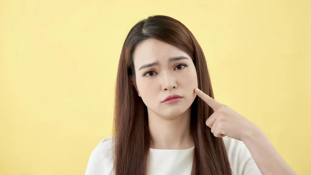 Ilustrasi perempuan dengan bekas jerawat. ©makistock/depositphotos.com