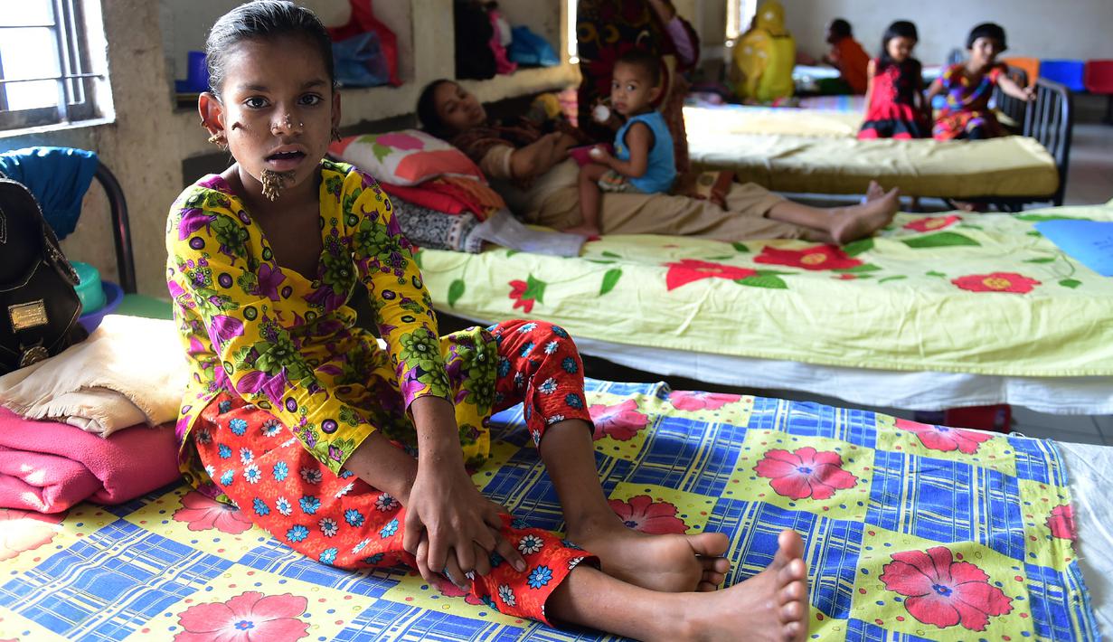 Sahana Khatun ketika tengah menjalani perawatan di sebuah rumah sakit di Dhaka, Bangladesh, 30 Januari 2017. Kutil tersebut muncul pada empat bulan lalu, kemudian tumbuh dan menyebar semakin banyak di wajah gadis 10 tahun tersebut. (STR/AFP)