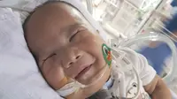 Mengenang Adam Fabumi di Instagram, Bayi Lucu Pengidap Trisomy 13