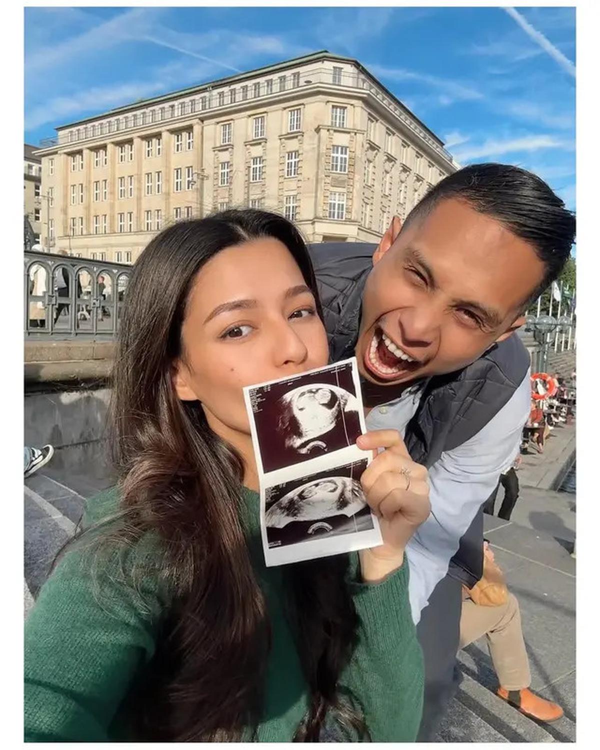 6 Potret Susan Sameh Umumkan Hamil Anak Pertama di Jerman, Pamerkan Hasil USG