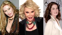 Berniat operasi plastik untuk mempercantik wajah, 7 wajah artis Hollywood ini justru terlihat aneh dan mengerikan. (foto: berbagai sumber)