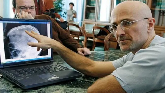 Sergio Canavero