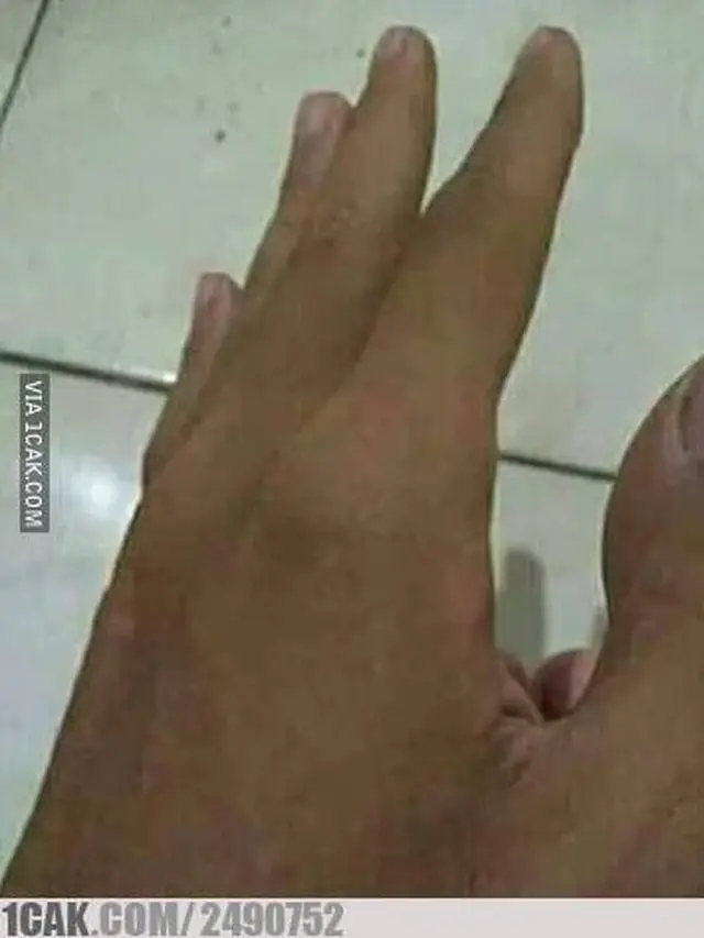 9 Potret Tangan dan Kaki Orang 'Ngebug' Ini Bikin Bingung Lihatnya