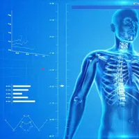 oestoporosis/pixabay