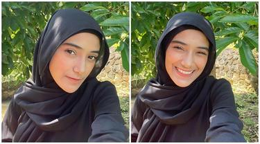 Kerap Ditanya Netizen, Ini 6 Potret Nadya Mustika Pamer Senyum Kelihatan Gigi