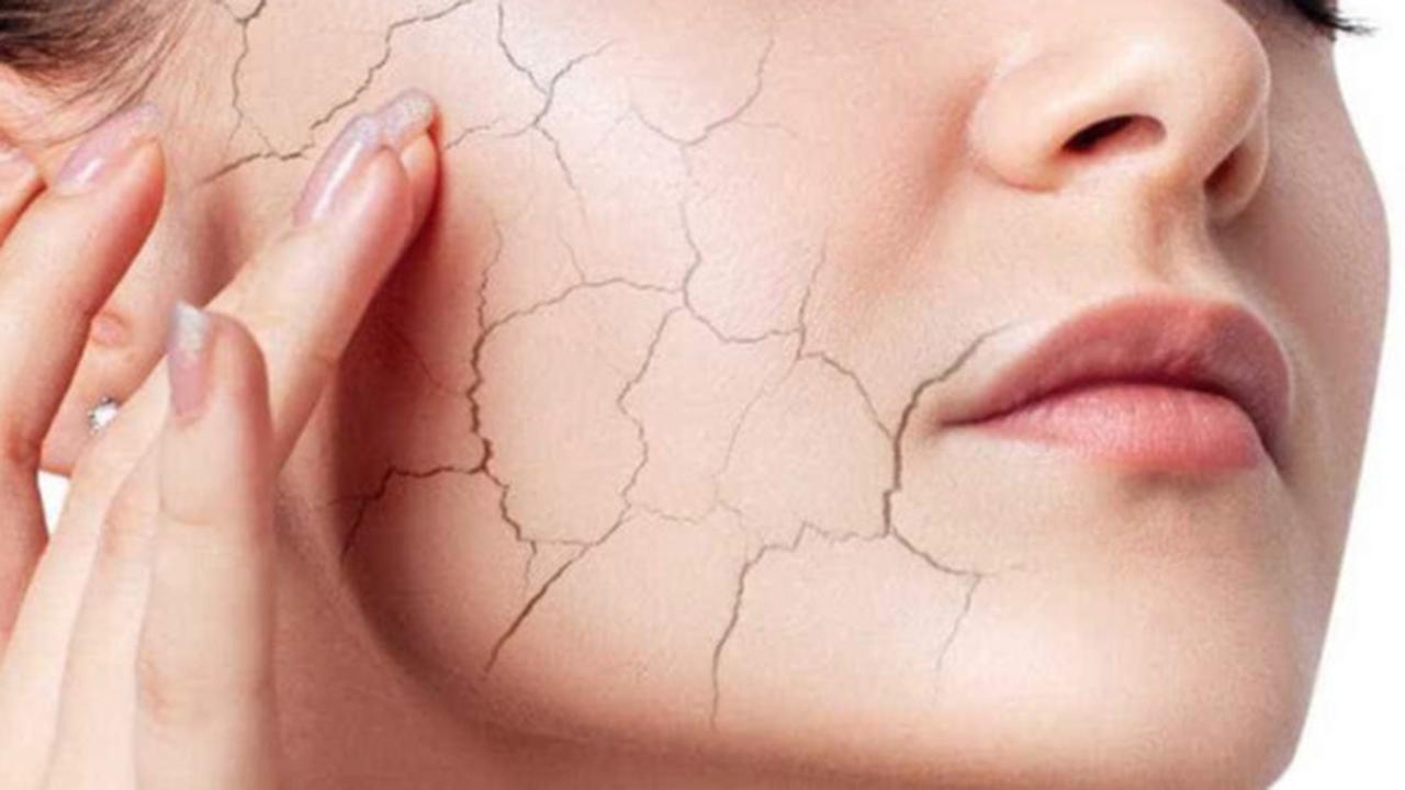 Cara Mengatasi Kulit Kering: Panduan Lengkap untuk Kulit Sehat dan Lembap