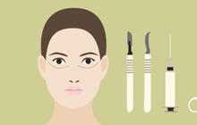 Jadi buron, wanita Korea bolak balik operasi sampai 6 tahun