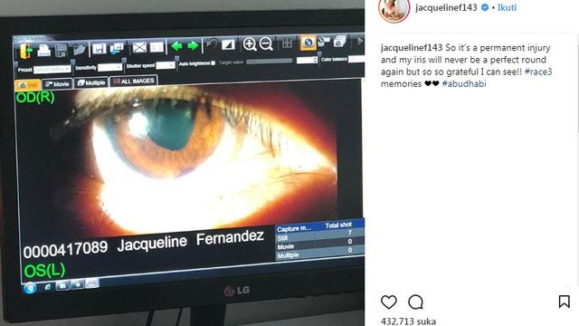 Mata Jacqueline Fernandez