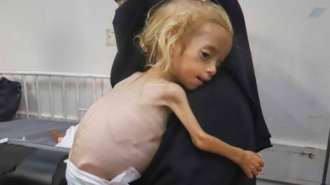 FOTO: Dari Gaza ke Italia, Perjuangan Kecil Shamm Qudeih
