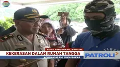 Tak terima istri minta cerai, sang suami siram istrinya itu dengan soda api mendidih.