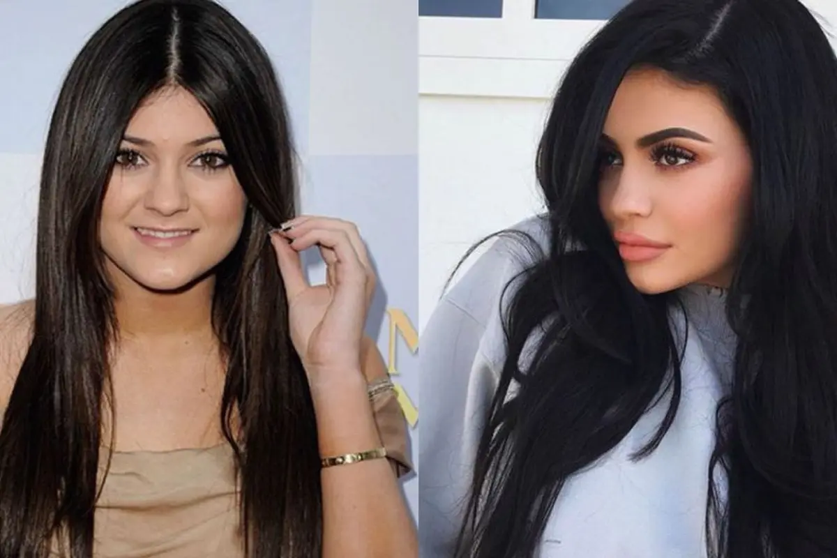 Perubahan Kylie Jenner Dulu dan Sekarang, Mana yang Lebih Menarik?